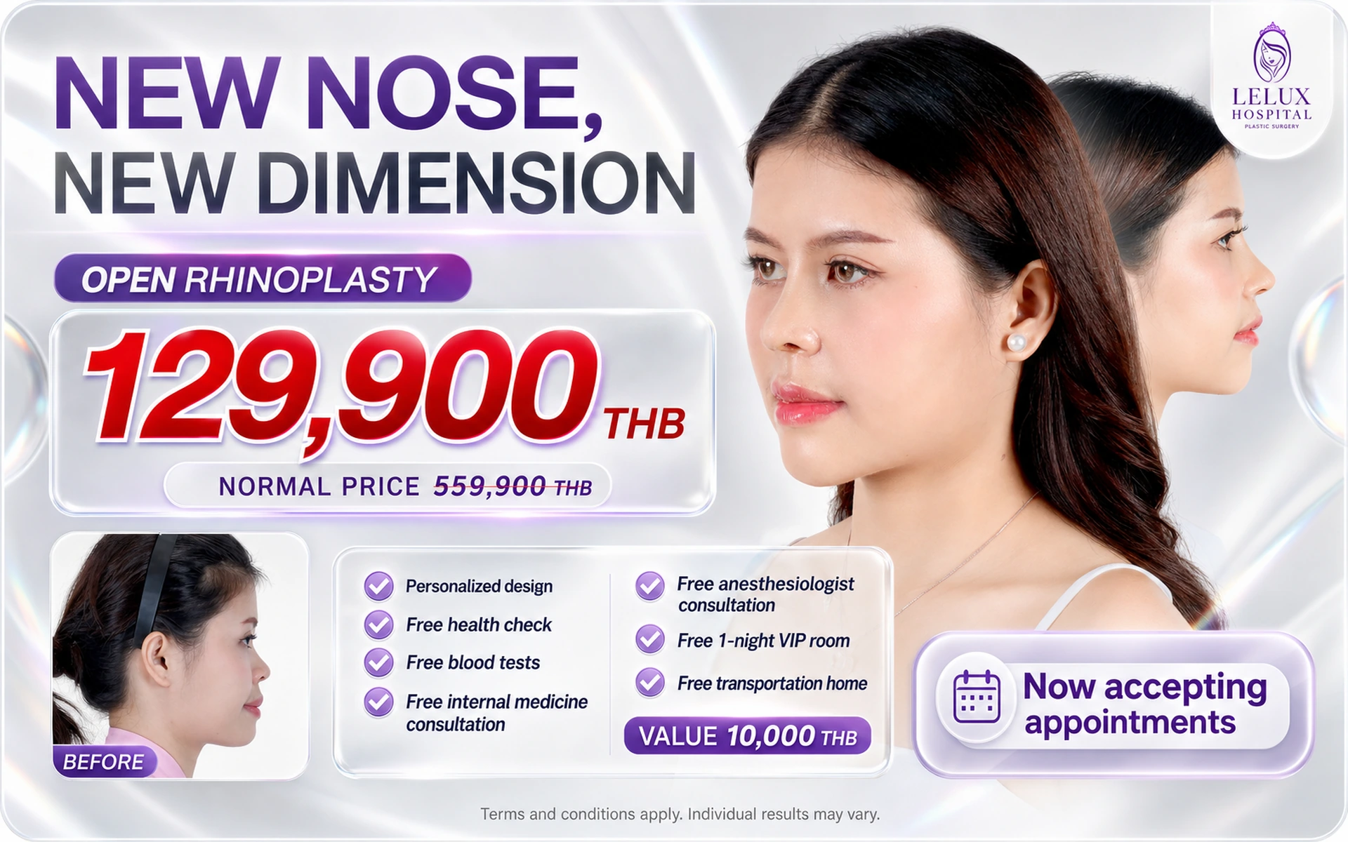 06-open-rhinoplasty