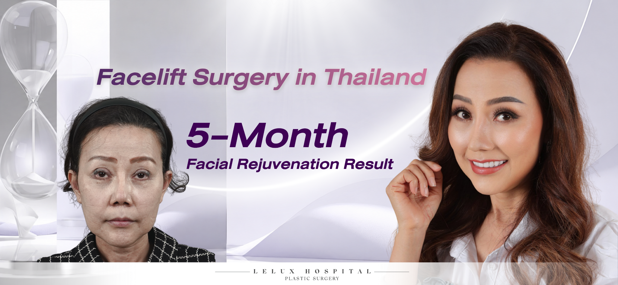Facelift Case Review at Lelux Hospital