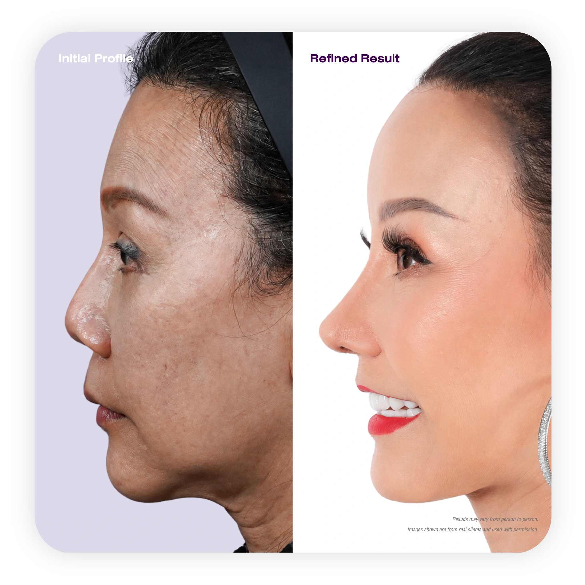profile_refined_1