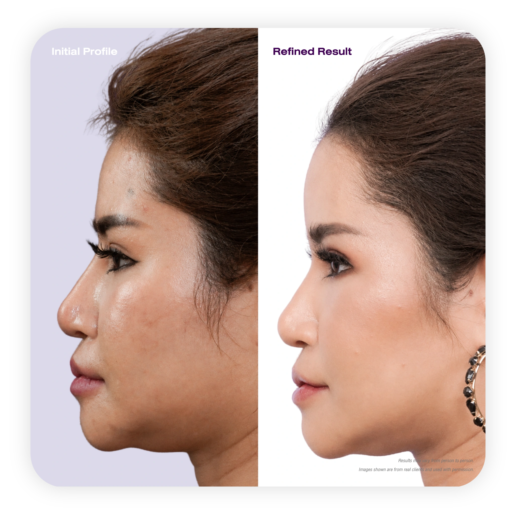 profile_refined_2