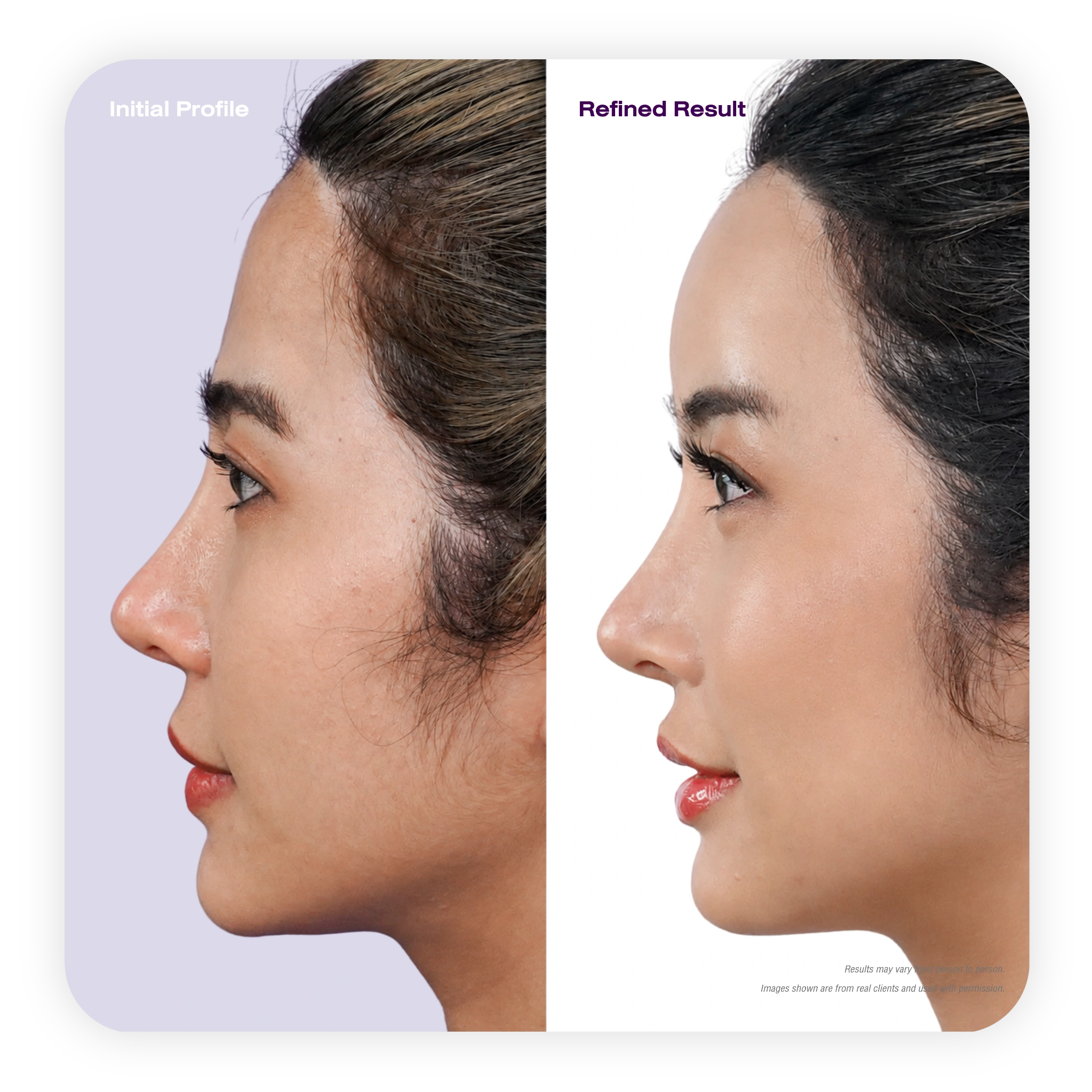 profile_refined_3