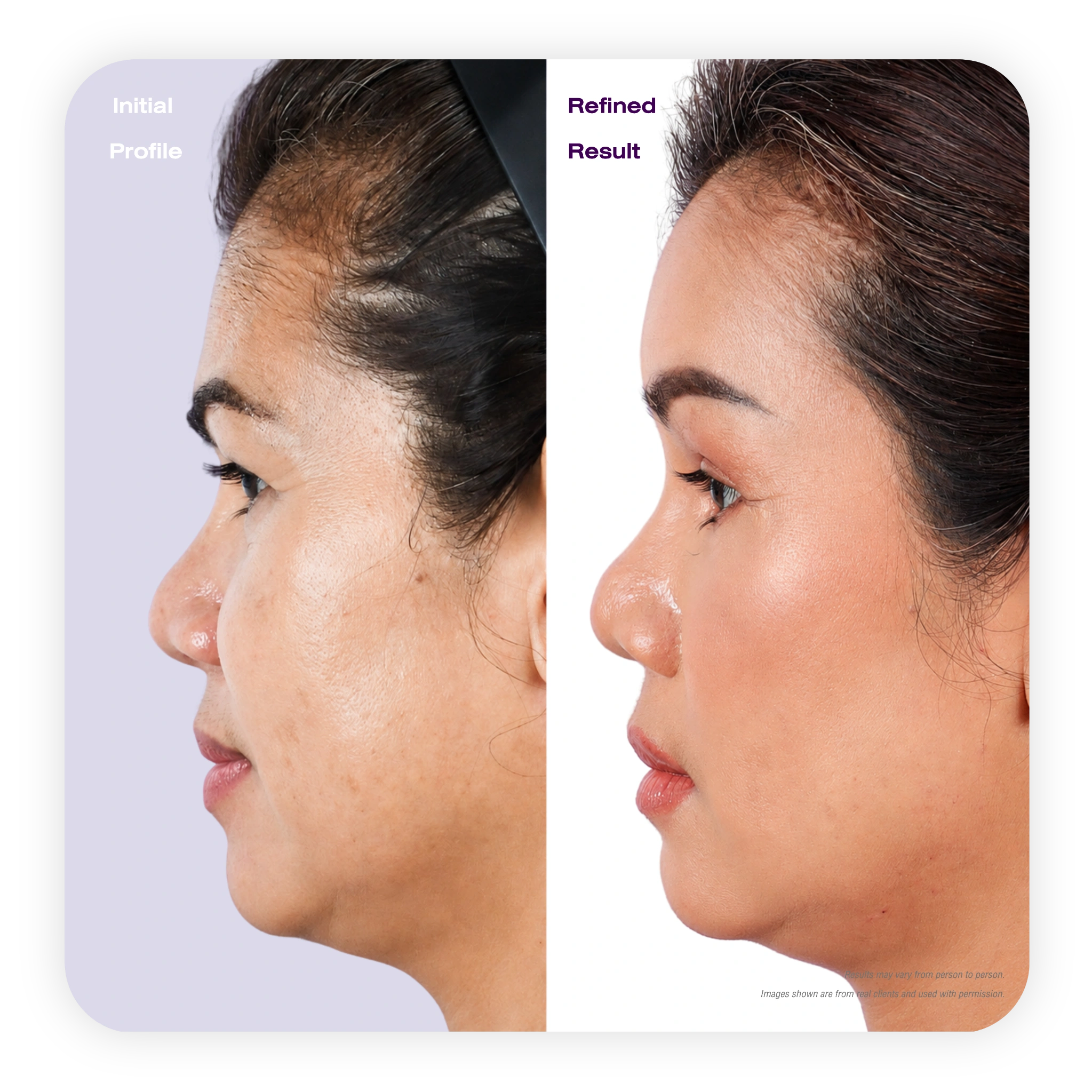 profile_refined_4