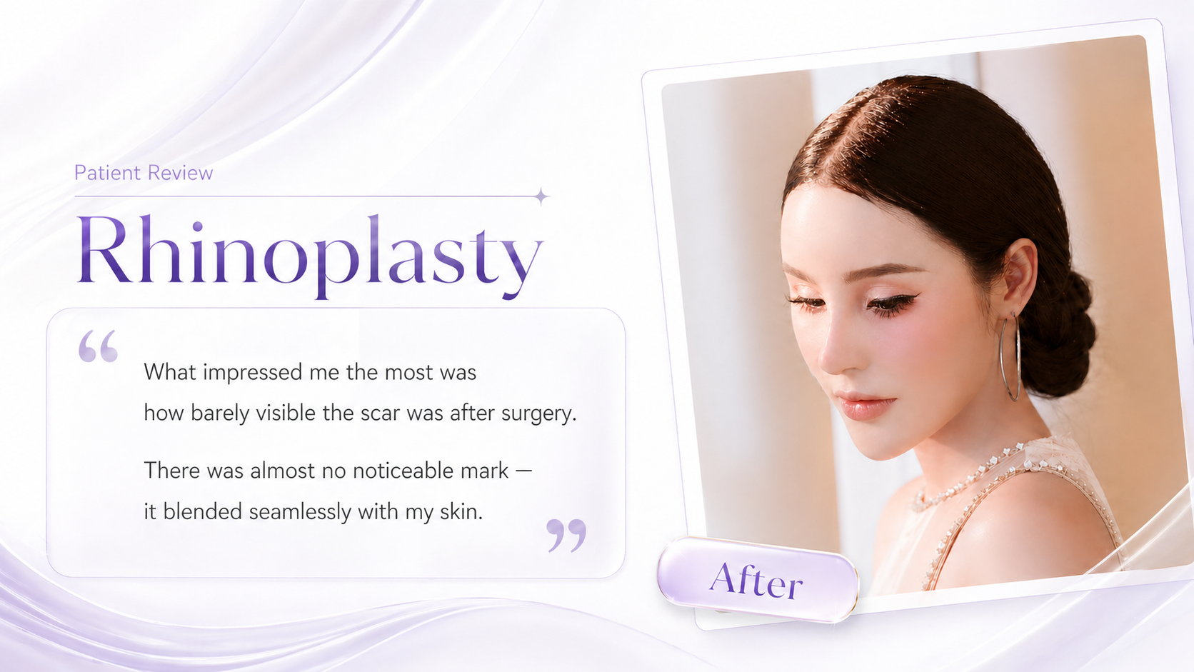 rhinoplasty_review_3